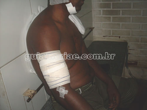 Homem leva facada de vizinho no Santo Antônio