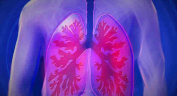 A asma pode matar se não for tratada corretamente