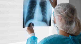 Tuberculose mata 4 mil brasileiros por ano; conheça a doença e os sintomas